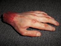 Severed Hands (Standard Finish) image 2